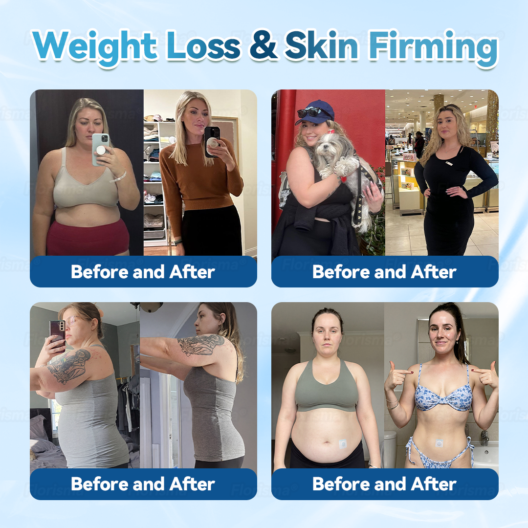 𝓞𝒇𝒇𝙞𝒄𝙞𝒂𝒍 𝑺𝒕𝙤𝒓𝓮 | 𝐅𝖑𝗼𝐫𝒊𝐬𝒎𝐚® 𝐏𝗜𝐚𝐧𝐭-𝐃𝐞𝐫𝐢𝐯𝐞𝐝 𝐂𝐞𝗜𝗜𝐮𝗜𝐚𝐫 𝐒𝐮𝐩𝐩𝐨𝐫𝐭 𝐂𝐨𝐦𝐩𝗜𝐞𝐱 𝐏𝐚𝐭𝐜𝐡💠(𝗜𝗺𝗽𝗿𝗼𝘃𝗲 𝗹𝘆𝗺𝗽𝗵𝗮𝘁𝗶𝗰 𝗱𝗿𝗮𝗶𝗻𝗮𝗴𝗲 & 𝗿𝗲𝗱𝘂𝗰𝗲 𝗯𝗼𝗱𝘆 𝘄𝗲𝗶𝗴𝗵𝘁)
