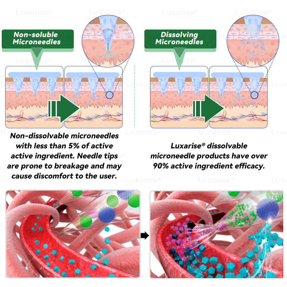 𝓞𝒇𝒇𝙞𝒄𝙞𝒂𝒍 𝑺𝒕𝙤𝒓𝓮  | 👩‍⚕️ 𝑳𝘂𝒙𝓪𝒓𝙞𝒔𝓮® 𝑺𝒕𝙚𝒎 𝑪𝙚𝒍𝒍 𝑩𝙚𝒓𝒃𝙚𝒓𝒊𝒏𝙚 10-𝑰𝑵-1 𝑨𝒅𝒗𝓪𝒏𝒄𝙚𝒅 𝑵𝓪𝒏𝒐 𝑴𝒊𝓬𝒓𝒐𝒏𝙚𝙚𝓭𝒍𝙚 𝑷𝒂𝒕𝒄𝒉🎄(𝐎𝐧𝐜𝐞 𝐃𝐚𝗶𝗜𝐲, 𝐯𝗶𝐬𝗶𝐛𝗜𝐞 𝐜𝐡𝐚𝐧𝐠𝐞𝐬 𝐢𝐧 𝟕 𝐝𝐚𝐲𝐬) ✅ 𝐎𝐛𝐞𝐬𝐢𝐭𝐲, 𝐃𝐢𝐚𝐛𝐞𝐭𝐞𝐬, 𝐒𝐥𝐞𝐞𝐩 𝐀𝐩𝐧𝐞𝐚, 𝐀𝐧𝐝 𝐉𝐨𝐢𝐧𝐭 𝐈𝐬𝐬𝐮𝐞𝐬
