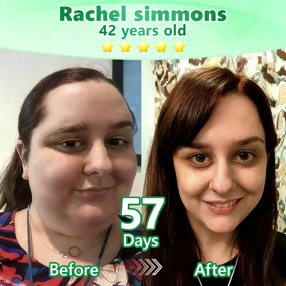 𝑶𝒇𝒇𝒊𝒄𝒊𝒂𝒍 𝑺𝒕𝒐𝒓𝒆|👩‍⚕️𝑳𝒖𝒙𝒂𝒓𝒊𝒔𝒆® 𝑴𝒐𝒓𝒊𝒏𝒈𝒂 & 𝑩𝒆𝒓𝒃𝒆𝒓𝒊𝒏𝒆 10-𝑰𝑵-1 𝑨𝒅𝒗𝒂𝒏𝒄𝒆𝒅 𝑵𝒂𝒏𝒐 𝑴𝒊𝒄𝒓𝒐𝒏𝒆𝒆𝒅𝒍𝒆 𝑷𝒂𝒕𝒄𝒉(𝐎𝐧𝐜𝐞 𝐃𝐚𝐢𝐥𝐲, 𝐯𝐢𝐬𝐢𝐛𝐥𝐞 𝐜𝐡𝐚𝐧𝐠𝐞𝐬 𝐢𝐧 𝟕 𝐝𝐚𝐲𝐬)✅ 𝐎𝐛𝐞𝐬𝐢𝐭𝐲, 𝐃𝐢𝐚𝐛𝐞𝐭𝐞𝐬, 𝐒𝐥𝐞𝐞𝐩 𝐀𝐩𝐧𝐞𝐚, 𝐀𝐧𝐝 𝐉𝐨𝐢𝐧𝐭 𝐈𝐬𝐬𝐮𝐞𝐬🦘
