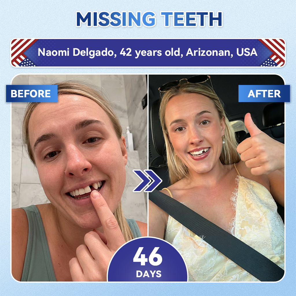 𝐆𝐥𝐢𝐦𝐦𝐞𝐫𝐥𝐲® 🦷𝐓𝐢𝐝𝐞𝐠𝐥𝐮𝐬𝐢𝐛 𝐓𝐨𝐨𝐭𝐡 & 𝐆𝐮𝐦 𝐑𝐞𝐩𝐚𝐢𝐫 𝐌𝐢𝐜𝐫𝐨𝐧𝐞𝐞𝐝𝐥𝐞 𝐏𝐚𝐭𝐜𝐡  | 𝐀𝐝𝐯𝐚𝐧𝐜𝐞𝐝 𝐒𝐭𝐞𝐦-𝐂𝐞𝐥𝐥 𝐀𝐜𝐭𝐢𝐯𝐚𝐭𝐢𝐨𝐧 𝐓𝐞𝐞𝐭𝐡 𝐒𝐭𝐫𝐢𝐩𝐬(𝐑𝐞𝐛𝐮𝐢𝐥𝐝 𝐄𝐧𝐚𝐦𝐞𝐥 & 𝐃𝐞𝐧𝐭𝐢𝐧 • 𝐒𝐭𝐫𝐞𝐧𝐠𝐭𝐡𝐞𝐧 𝐆𝐮𝐦𝐬 • 𝐄𝐫𝐚𝐝𝐢𝐜𝐚𝐭𝐞 𝐓𝐚𝐫𝐭𝐚𝐫 & 𝐎𝐝𝐨𝐫 • 𝐒𝐭𝐨𝐩 𝐓𝐨𝐨𝐭𝐡 𝐒𝐞𝐧𝐬𝐢𝐭𝐢𝐯𝐢𝐭𝐲)💎