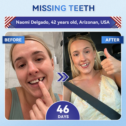 𝐆𝐥𝐢𝐦𝐦𝐞𝐫𝐥𝐲® 🦷𝐓𝐢𝐝𝐞𝐠𝐥𝐮𝐬𝐢𝐛 𝐓𝐨𝐨𝐭𝐡 & 𝐆𝐮𝐦 𝐑𝐞𝐩𝐚𝐢𝐫 𝐌𝐢𝐜𝐫𝐨𝐧𝐞𝐞𝐝𝐥𝐞 𝐏𝐚𝐭𝐜𝐡  | 𝐀𝐝𝐯𝐚𝐧𝐜𝐞𝐝 𝐒𝐭𝐞𝐦-𝐂𝐞𝐥𝐥 𝐀𝐜𝐭𝐢𝐯𝐚𝐭𝐢𝐨𝐧 𝐓𝐞𝐞𝐭𝐡 𝐒𝐭𝐫𝐢𝐩𝐬(𝐑𝐞𝐛𝐮𝐢𝐥𝐝 𝐄𝐧𝐚𝐦𝐞𝐥 & 𝐃𝐞𝐧𝐭𝐢𝐧 • 𝐒𝐭𝐫𝐞𝐧𝐠𝐭𝐡𝐞𝐧 𝐆𝐮𝐦𝐬 • 𝐄𝐫𝐚𝐝𝐢𝐜𝐚𝐭𝐞 𝐓𝐚𝐫𝐭𝐚𝐫 & 𝐎𝐝𝐨𝐫 • 𝐒𝐭𝐨𝐩 𝐓𝐨𝐨𝐭𝐡 𝐒𝐞𝐧𝐬𝐢𝐭𝐢𝐯𝐢𝐭𝐲)💎