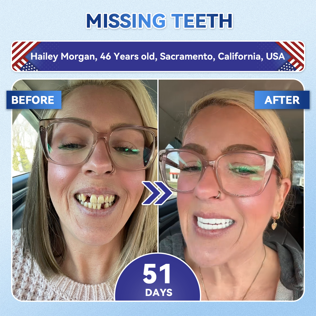 𝐆𝐥𝐢𝐦𝐦𝐞𝐫𝐥𝐲® 🦷𝐓𝐢𝐝𝐞𝐠𝐥𝐮𝐬𝐢𝐛 𝐓𝐨𝐨𝐭𝐡 & 𝐆𝐮𝐦 𝐑𝐞𝐩𝐚𝐢𝐫 𝐌𝐢𝐜𝐫𝐨𝐧𝐞𝐞𝐝𝐥𝐞 𝐏𝐚𝐭𝐜𝐡  | 𝐀𝐝𝐯𝐚𝐧𝐜𝐞𝐝 𝐒𝐭𝐞𝐦-𝐂𝐞𝐥𝐥 𝐀𝐜𝐭𝐢𝐯𝐚𝐭𝐢𝐨𝐧 𝐓𝐞𝐞𝐭𝐡 𝐒𝐭𝐫𝐢𝐩𝐬(𝐑𝐞𝐛𝐮𝐢𝐥𝐝 𝐄𝐧𝐚𝐦𝐞𝐥 & 𝐃𝐞𝐧𝐭𝐢𝐧 • 𝐒𝐭𝐫𝐞𝐧𝐠𝐭𝐡𝐞𝐧 𝐆𝐮𝐦𝐬 • 𝐄𝐫𝐚𝐝𝐢𝐜𝐚𝐭𝐞 𝐓𝐚𝐫𝐭𝐚𝐫 & 𝐎𝐝𝐨𝐫 • 𝐒𝐭𝐨𝐩 𝐓𝐨𝐨𝐭𝐡 𝐒𝐞𝐧𝐬𝐢𝐭𝐢𝐯𝐢𝐭𝐲)💎