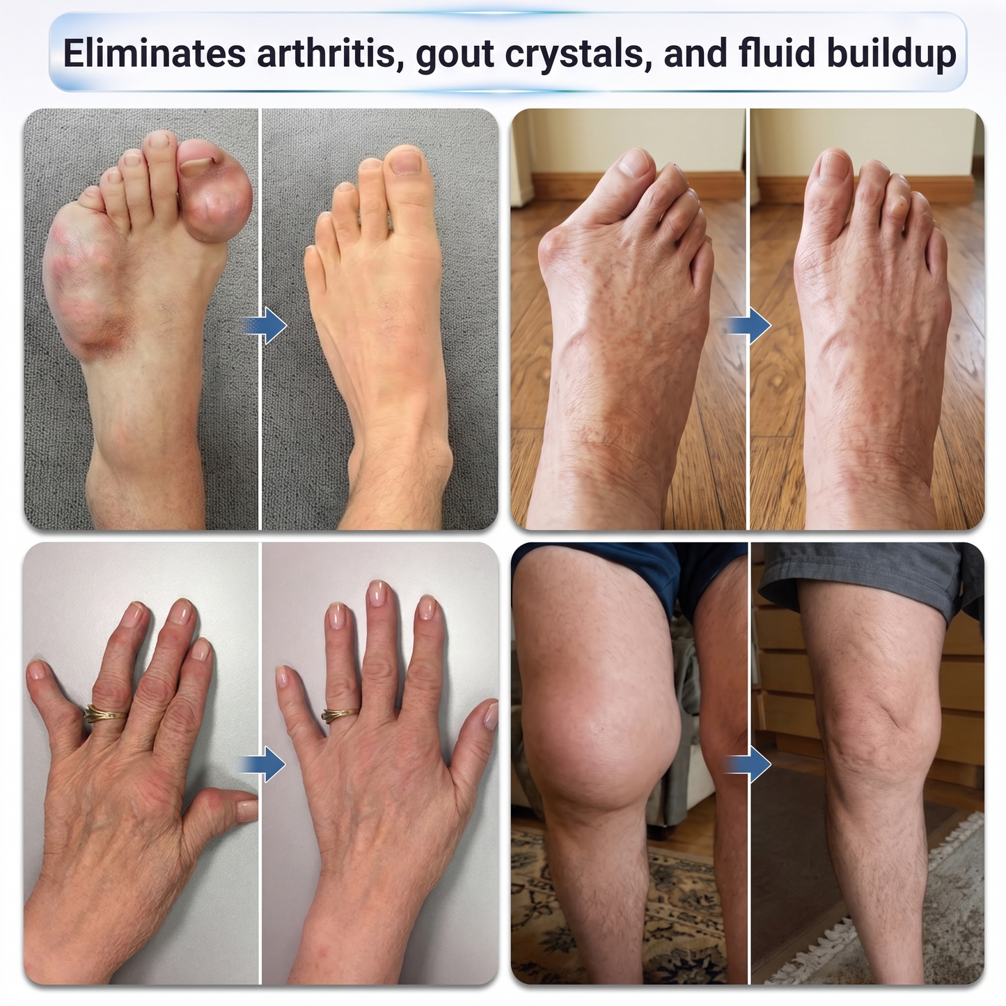 𝗜𝐅𝙈𝗔𝑮𝗜𝐂® 💠 𝟬.𝟬𝟱𝗺𝗺 𝐌𝐢𝐜𝐫𝗼𝗻𝗲𝗲𝙙𝙡𝙚 𝑩𝒐𝒏𝒆 & 𝐉𝐨𝗶𝗻𝘁 𝗥𝗼𝗹𝗹𝒆𝙧💧