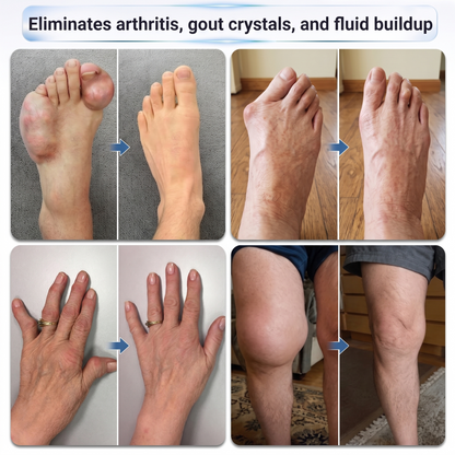 𝗜𝐅𝙈𝗔𝑮𝗜𝐂® 💠 𝟬.𝟬𝟱𝗺𝗺 𝐌𝐢𝐜𝐫𝗼𝗻𝗲𝗲𝙙𝙡𝙚 𝑩𝒐𝒏𝒆 & 𝐉𝐨𝗶𝗻𝘁 𝗥𝗼𝗹𝗹𝒆𝙧💧