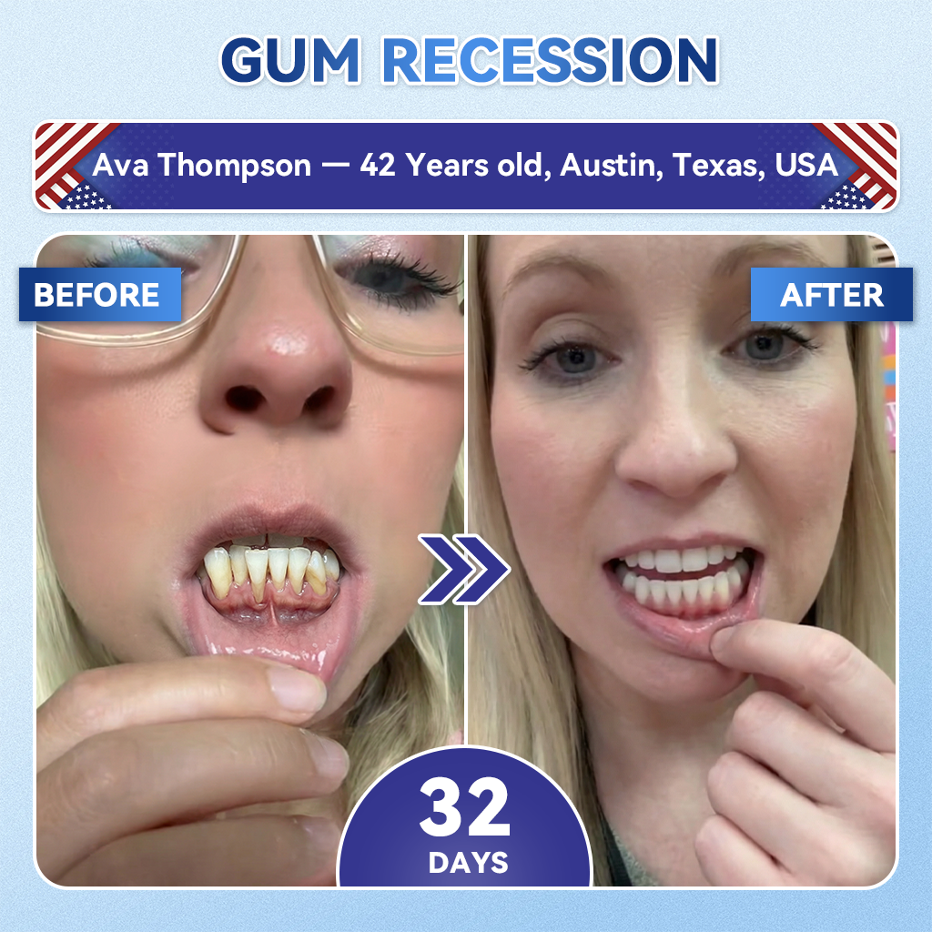 𝐆𝐥𝐢𝐦𝐦𝐞𝐫𝐥𝐲® 🦷𝐓𝐢𝐝𝐞𝐠𝐥𝐮𝐬𝐢𝐛 𝐓𝐨𝐨𝐭𝐡 & 𝐆𝐮𝐦 𝐑𝐞𝐩𝐚𝐢𝐫 𝐌𝐢𝐜𝐫𝐨𝐧𝐞𝐞𝐝𝐥𝐞 𝐏𝐚𝐭𝐜𝐡  | 𝐀𝐝𝐯𝐚𝐧𝐜𝐞𝐝 𝐒𝐭𝐞𝐦-𝐂𝐞𝐥𝐥 𝐀𝐜𝐭𝐢𝐯𝐚𝐭𝐢𝐨𝐧 𝐓𝐞𝐞𝐭𝐡 𝐒𝐭𝐫𝐢𝐩𝐬(𝐑𝐞𝐛𝐮𝐢𝐥𝐝 𝐄𝐧𝐚𝐦𝐞𝐥 & 𝐃𝐞𝐧𝐭𝐢𝐧 • 𝐒𝐭𝐫𝐞𝐧𝐠𝐭𝐡𝐞𝐧 𝐆𝐮𝐦𝐬 • 𝐄𝐫𝐚𝐝𝐢𝐜𝐚𝐭𝐞 𝐓𝐚𝐫𝐭𝐚𝐫 & 𝐎𝐝𝐨𝐫 • 𝐒𝐭𝐨𝐩 𝐓𝐨𝐨𝐭𝐡 𝐒𝐞𝐧𝐬𝐢𝐭𝐢𝐯𝐢𝐭𝐲)💎